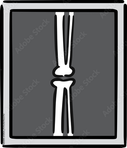 Illustration of x-ray film
