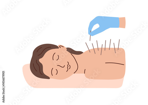 Acupuncture, woman patient with inserted acupuncture needles. Alternative medicine. Body therapy and spa, wellness and acupressure. Vector illustration