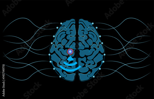 Human brain with implanted neural chip, works by recording and transmitting neural activity from the brain to a computer or other device.