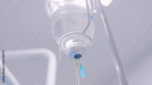 IV fluid bag and tubing drip chamber seen close-up under bright overhead lighting in a clinical hospital setting.