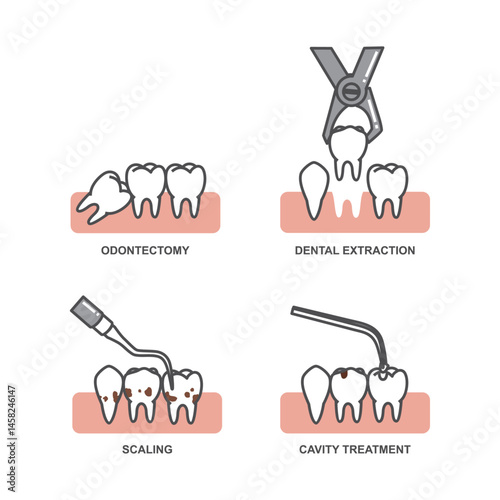 Illustration of dentistry procedures or activities