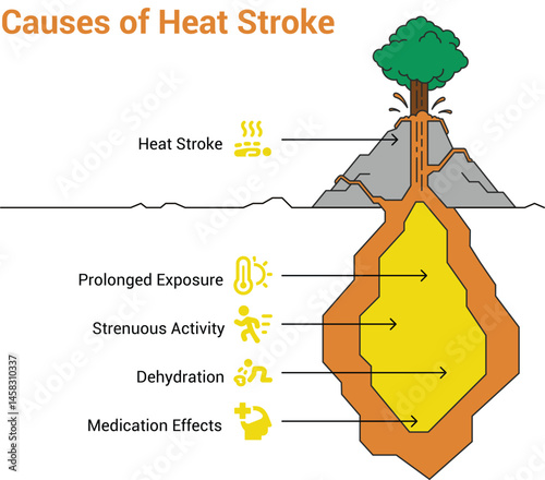 Causes of Heat Stroke: A simple illustration representing causes of heat stroke. The image features a tree erupting from a volcano, symbolizing the symptoms of heat stroke.  