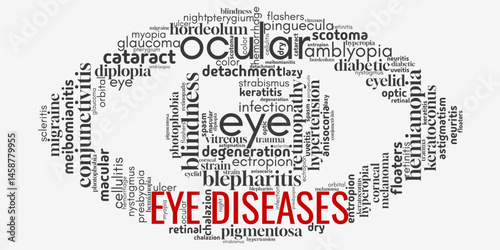 Word cloud centered on "Eye Diseases", filled with terms about vision problems, conditions, and treatments. Ideal for health, medical awareness, and ophthalmology-related visuals