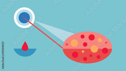Inflammation Reduction A graphic depicting a lasertreated area with subduing inflammation showing exosomes contributing to cooling and reducing redness around the treated zone.