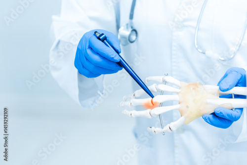 Orthopedist explain to the patient for human hand and fingers bone injury treatment program.Doctor showing to finger bones anatomy to gout patient.Physiotherapy present hand model for injured athlete.