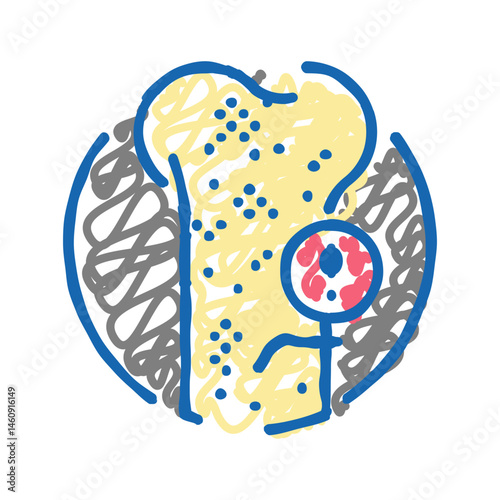 severe osteoporosis bone icon doodle illustration