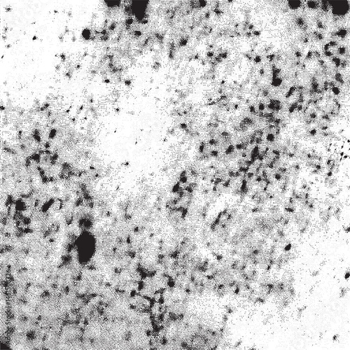 A textured black and white surface displays a complex of scattered dark spots.