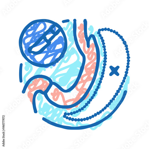 gastrectomy surgery doctor icon doodle illustration