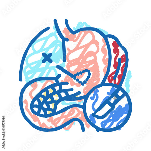 pancreatectomy surgery hospital icon doodle illustration