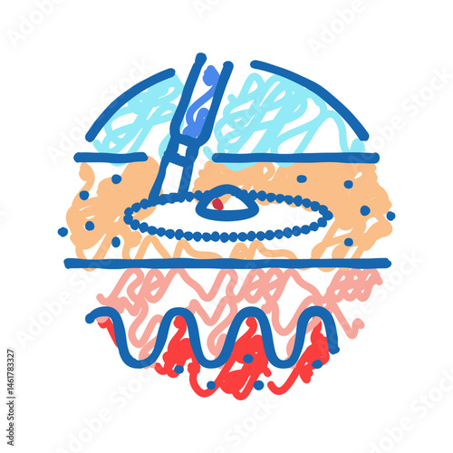 dilation and curettage surgery icon doodle illustration