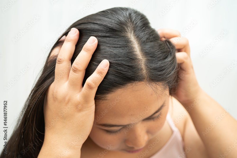Fototapeta premium Asian women have problems with itchy scalp and dandruff.
