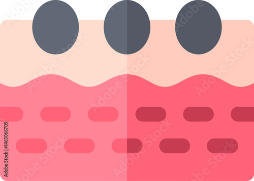 blackhead illustration on a white background     