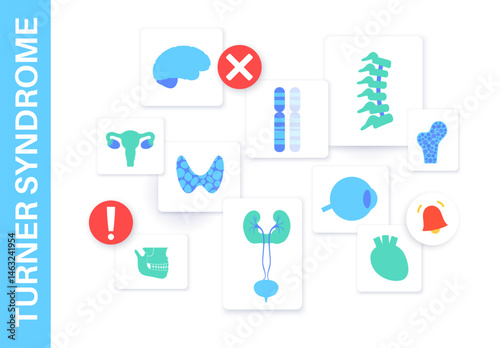 Turner syndrome poster