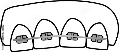 Dental braces