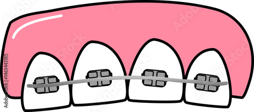 Dental braces