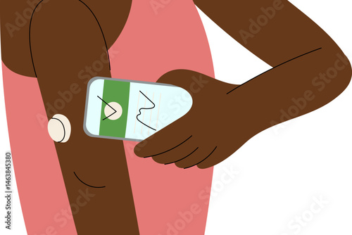 Woman wearing a wearable blood sugar monitor. Continuous glucose monitor . Diabetes management and health technology.