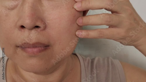 Portrait the fingers holding the flabbiness adipose sagging skin, swelling and ptosis beside the eyelids, dark spots and blemish, freckles and scar, Flabby skin on the face, health care and beauty.