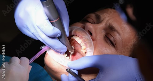 Dentist drills woman teeth with high speed hand piece at treatment in clinic. Nervous patient with cheek retractor and saliva ejector in hospital