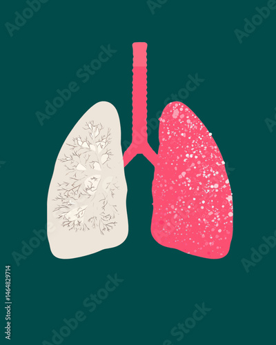 Lungs with disease illustration