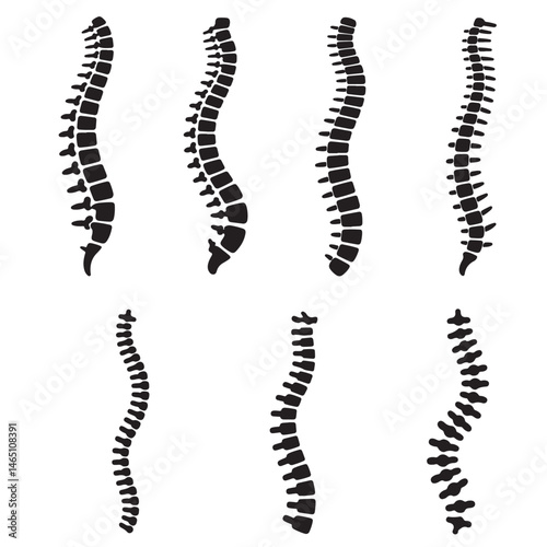 set vector various Spinal cord silhouettes , Spine Illustrations Showing Different Curvatures. Collection of Spinal Column Illustrations Anatomy Vertebrae