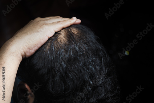 Man touching his balding scalp in a dimly lit setting