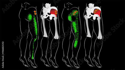 Fotografie Gluteus minimus