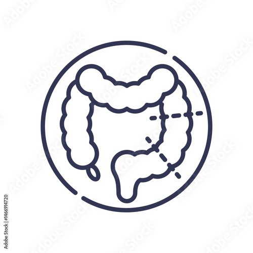 Illustration of a colon, indicating surgical removal or medical examination.