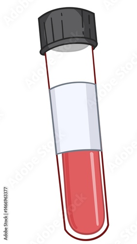 Blood test, blood in a medical vacuum tube