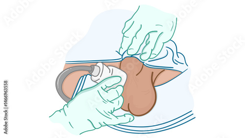 Performing a scrotum Ultrasound (US)