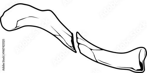 Schwarz-Weiß Illustration eines gebrochenen Schlüsselbeins
