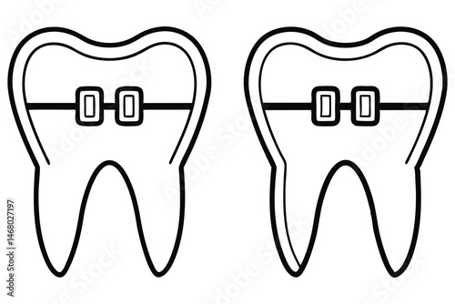 Two outline teeth are shown with braces attached to them on white