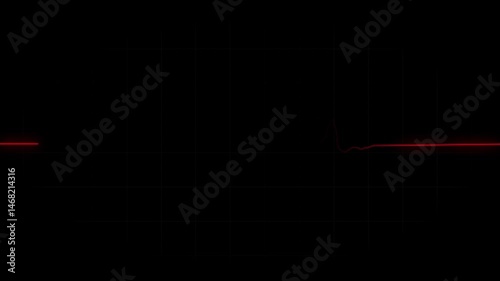 Red EKG flatline. Cardiogram pulse monitor showing heart attack emergency or cardiac arrest. Medical device animation.
