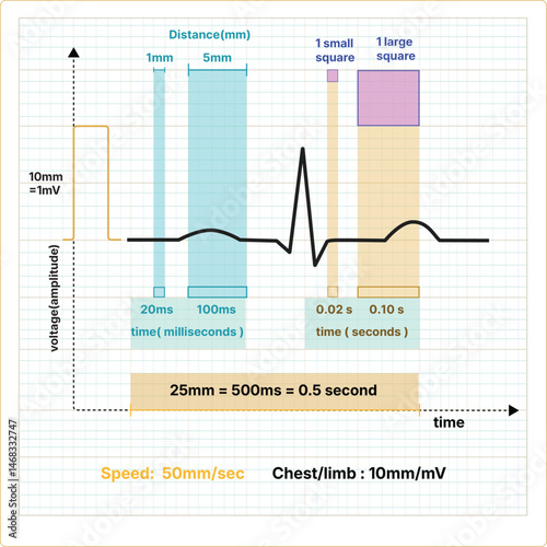 ECG Grid Interpretation with Time and Voltage Measurements – Medical Infographic