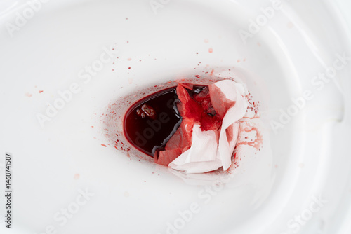 Blood from hemorrhoids or menstruation in the flushed. Clean flush toilet after the stools that are bleeding because of hemorrhoids. Blood from hemorrhoids or menstruation in the flushed toilet.