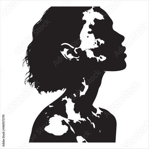 Black vitiligo skin silhouette with distinct light patches, clear white background for contrast