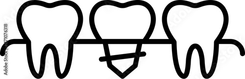 Minimalistic Icon of Dental Implant for Graphics, Concept, Apps