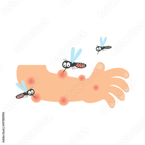 mosquito bite. dengue fever concept
