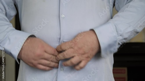 Overweight man's shirt buttons unbutton and come off on stomach due to big belly close-up, person suffering from obesity