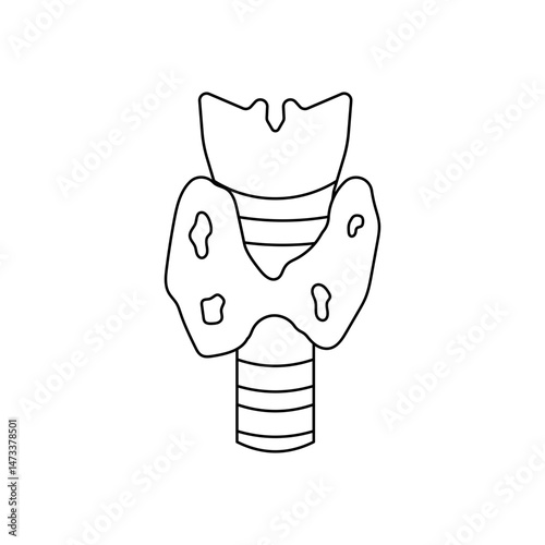 Thyroid cancer