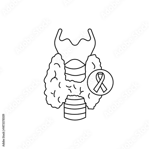 Thyroid cancer
