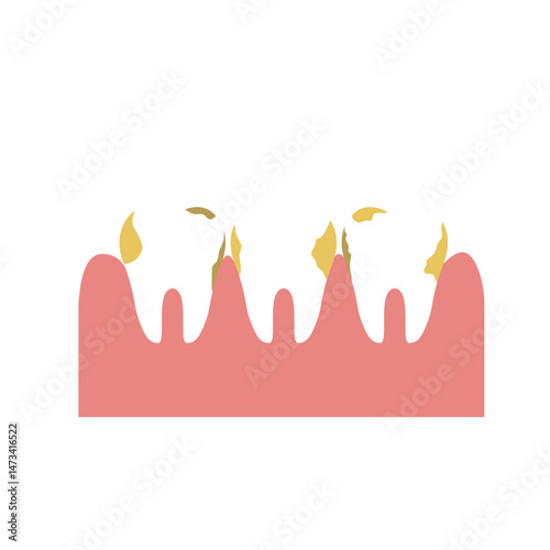 dental plaque