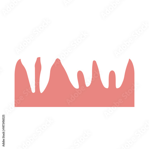 dental malocclusion