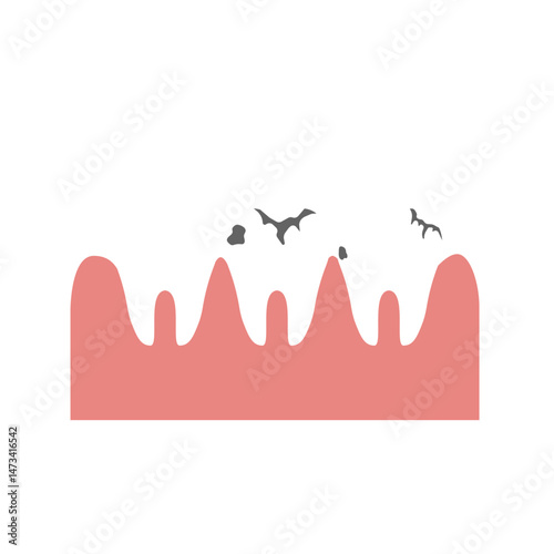 dental caries
