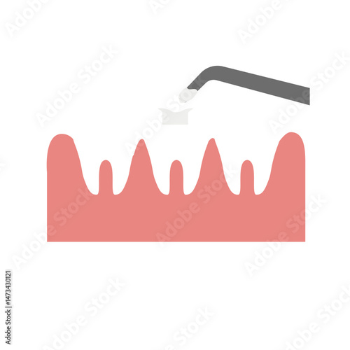 dental restoration