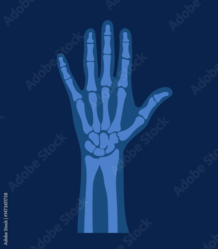 Flat illustration of x-ray of human healthy hand. Scientific cartoon simple picture.