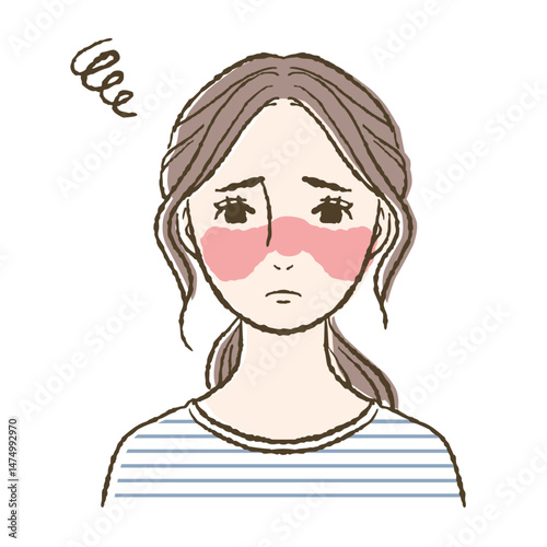 蝶形紅斑に悩む女性のイラスト