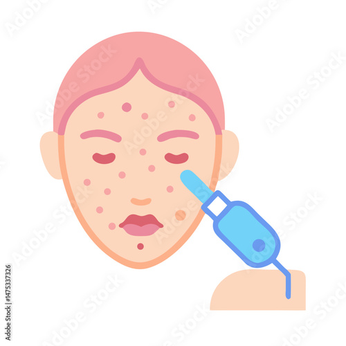 Skin treatment for acne using modern technology vector illustration
