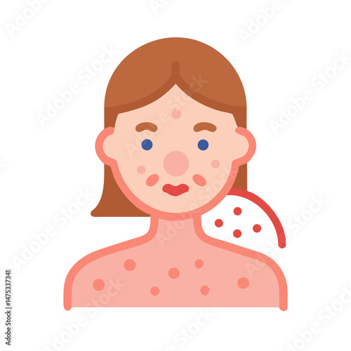 Illustration of a woman with rash or skin condition