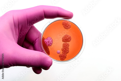 Doctor's or scientist's hand with a microbiological culture dish with colonies of bacteria and yeast	