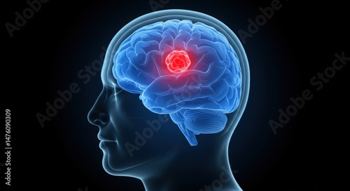 Wallpaper Mural Brain Scan with Red Spot on Black Background Torontodigital.ca